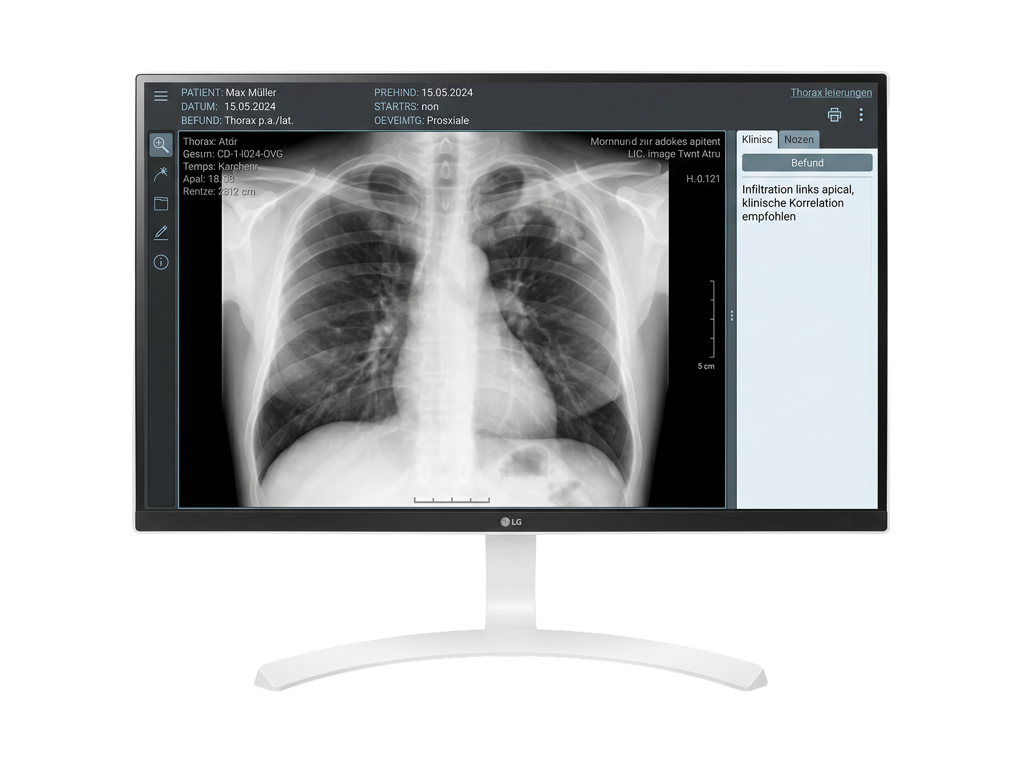 Lenovo 27" 4K UHD Surgical Monitor 4Z91M76100